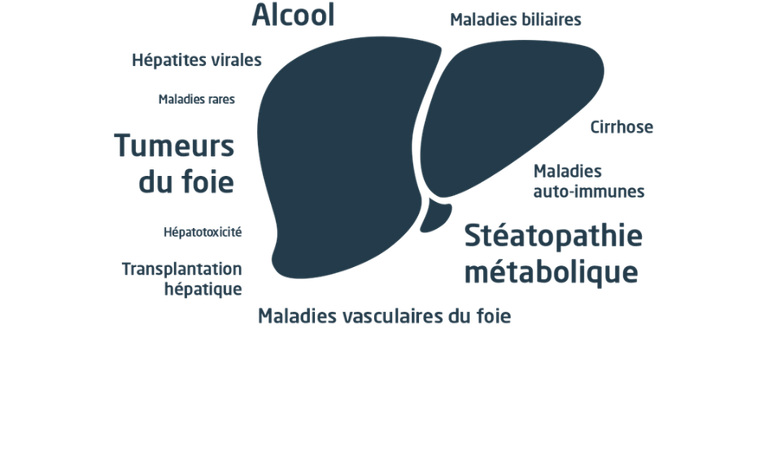 Foie - maladies